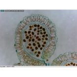 Dino-Lite ipari digitális mikroszkóp csomag 10-50-200x